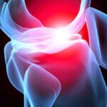 osteoarthritida_neo_farmako
