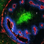 δοκιμή αντικαρκινικών φαρμάκων