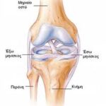 οστεοαρθρίτιδα