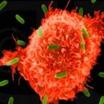 παράθυρο δείχνει την εξάπλωση του καρκίνου