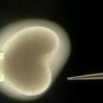 FoxO: Το γονίδιο της μακροζωίας