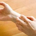 Τα νεύρα που ευθύνονται για τη φαγούρα