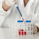 Οι φυσιολογικές τιμές των εργαστηριακών εξετάσεων