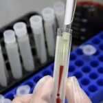 Ο «χάρτης» προς αποτελεσματικό εμβόλιο για το AIDS