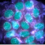 Καρκινικά κύτταρα... καταστέλλουν τον καρκίνο