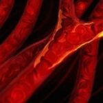 periferiki-artiriopatheia