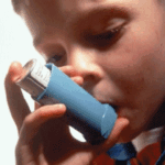 asthma